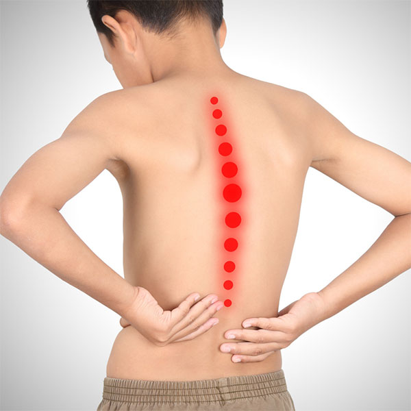 Should You Be Worried About Heavy School Bags & Scoliosis?