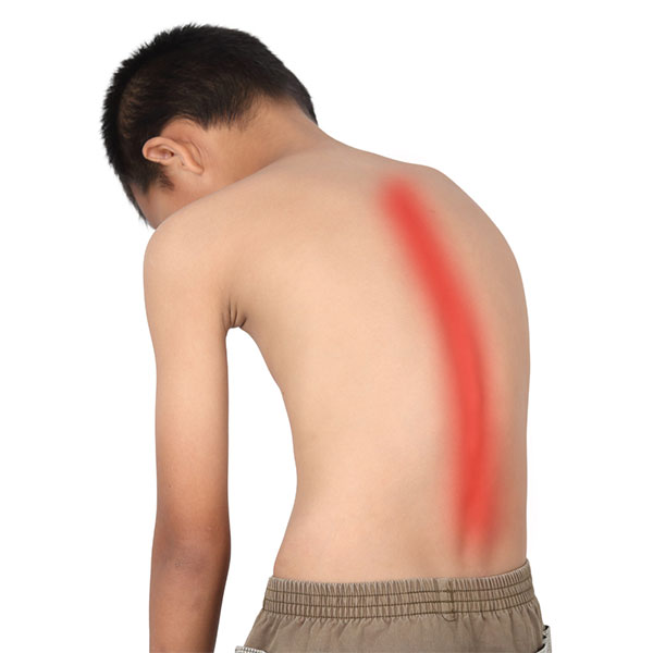 Should You Be Worried About Heavy School Bags & Scoliosis?