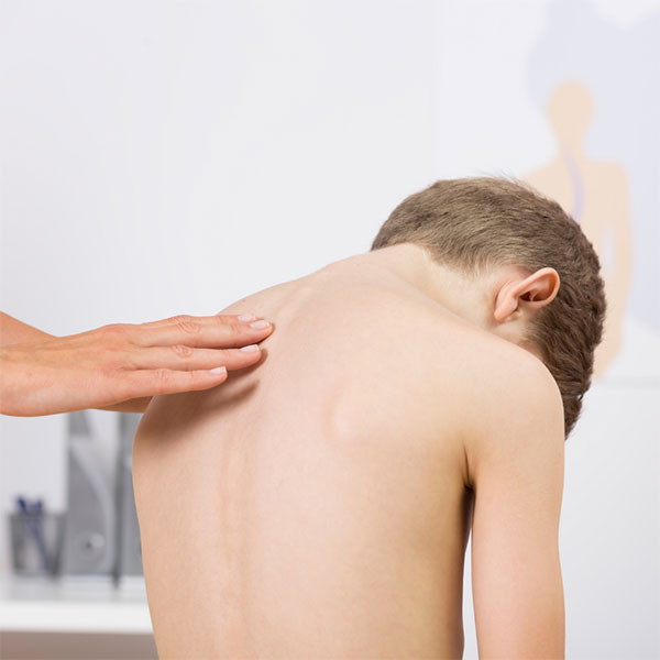 Should You Be Worried About Heavy School Bags & Scoliosis?