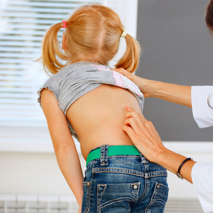 Should You Be Worried About Heavy School Bags & Scoliosis?